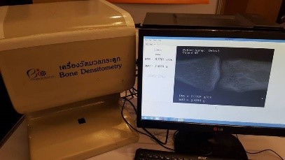 เครื่องวัดความหนาแน่นมวลกระดูก